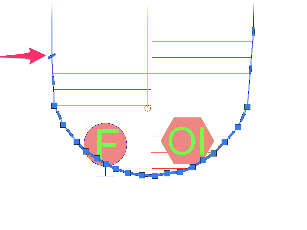 Abnormality in drip area boundary